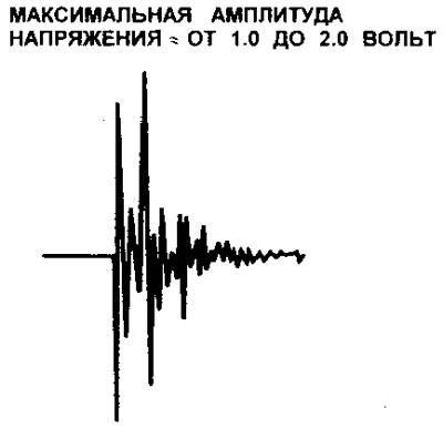11.25 Тыпавая форма хвалі выходнага сігналу датчыка дэтанацыі KS