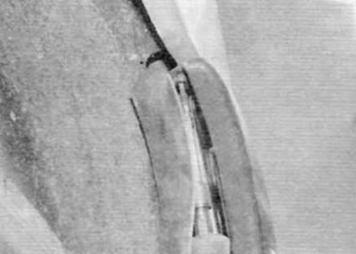 Figure 7.4. Remove the screw securing the upper front corner of the bumper to the rear wing