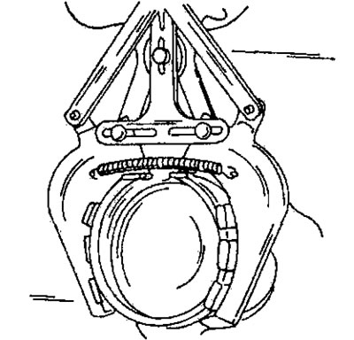 Рис. 120. Снятие поршневых колец с помощью специальных щипцов.